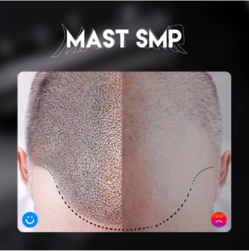 Mast SMP zestaw do pmu, smp i tatuażu